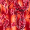 International Journal of Clinical Microbiology - Acute lymphoblastic leukemia